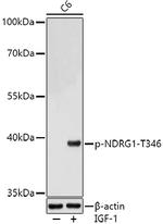 Phospho-NDRG1 (Thr346) Polyclonal Antibody
