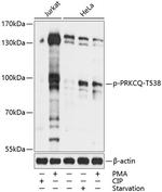 Phospho-PKC theta (Thr538) Polyclonal Antibody