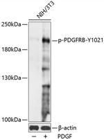 Phospho-PDGFRB (Tyr1021) Polyclonal Antibody