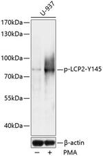 Phospho-SLP76 (Tyr145) Polyclonal Antibody
