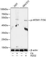 Phospho-AP2M1 (Thr156) Polyclonal Antibody