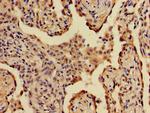 A2ML1 Polyclonal Antibody