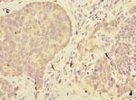 ABHD2 Antibody in Immunohistochemistry (Paraffin) (IHC (P))