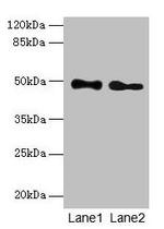 ABHD2 Antibody in Western Blot (WB)