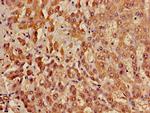 ACADL Polyclonal Antibody