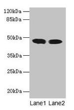 ACADL Antibody in Western Blot (WB)
