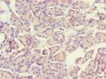 ACADS Polyclonal Antibody