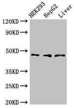 SBCAD Antibody in Western Blot (WB)