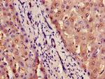 ILF2 Antibody in Immunohistochemistry (Paraffin) (IHC (P))