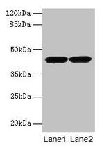 ACTRT2 Polyclonal Antibody