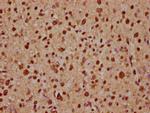 ADAR1 Polyclonal Antibody