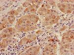 Alcohol Dehydrogenase 1B Antibody in Immunohistochemistry (Paraffin) (IHC (P))