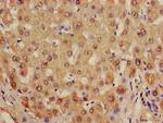 Alcohol Dehydrogenase 1B Antibody in Immunohistochemistry (Paraffin) (IHC (P))
