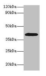 Alcohol Dehydrogenase 1B Antibody in Western Blot (WB)