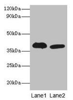 ADH5 Polyclonal Antibody
