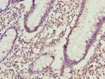 ADPGK Polyclonal Antibody