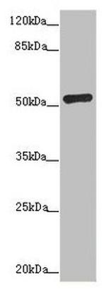 ADPGK Antibody in Western Blot (WB)