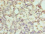 ADSL Polyclonal Antibody