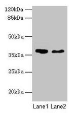 AGA Polyclonal Antibody