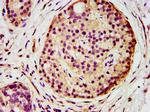 AGPS Antibody in Immunohistochemistry (Paraffin) (IHC (P))