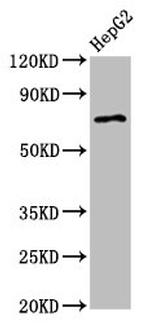 AGPS Antibody in Western Blot (WB)