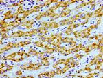 AGXT Antibody in Immunohistochemistry (Paraffin) (IHC (P))