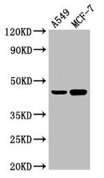 AGXT Antibody in Western Blot (WB)