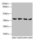 AKR1C2 Polyclonal Antibody