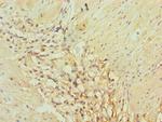 AKR1C3 Polyclonal Antibody