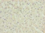ALAS2 Antibody in Immunohistochemistry (Paraffin) (IHC (P))