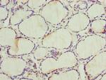 ALAS2 Polyclonal Antibody