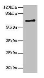 ALAS2 Antibody in Western Blot (WB)