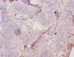 AMH Polyclonal Antibody