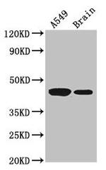 AMT Polyclonal Antibody
