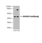 Annexin A9 Antibody in Western Blot (WB)