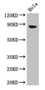 APEH Antibody in Western Blot (WB)