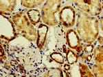 ASAH2 Antibody in Immunohistochemistry (Paraffin) (IHC (P))
