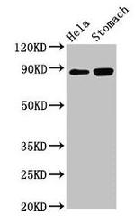 ASAH2 Antibody in Western Blot (WB)