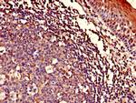 ASCC1 Antibody in Immunohistochemistry (Paraffin) (IHC (P))
