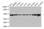 ASCC1 Antibody in Western Blot (WB)