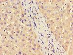ASS1 Polyclonal Antibody