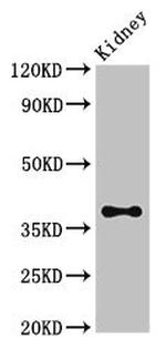 ATOH1 Polyclonal Antibody