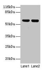 ATP5A1 Polyclonal Antibody