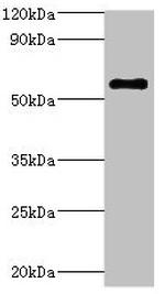 ATP6V1B2 Polyclonal Antibody