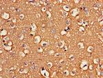 ATP6V1G2 Antibody in Immunohistochemistry (Paraffin) (IHC (P))