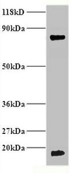 Hemoglobin Antibody in Western Blot (WB)
