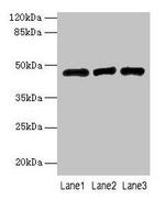 B3GNT2 Antibody in Western Blot (WB)