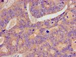 p130Cas Antibody in Immunohistochemistry (Paraffin) (IHC (P))