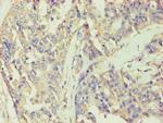 BCKDK Polyclonal Antibody