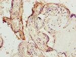 Bisphosphoglycerate mutase Polyclonal Antibody